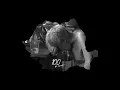 thumbnail_RH8lvWxHY34
